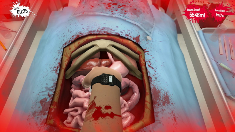 Surgeon Simulator: Anniversary Edition - screenshot 35